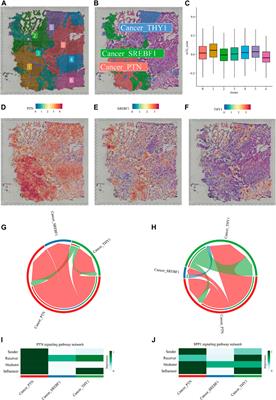 A novel prognostic 7-methylguanosine signature reflects immune microenvironment and alternative splicing in glioma based on multi-omics analysis